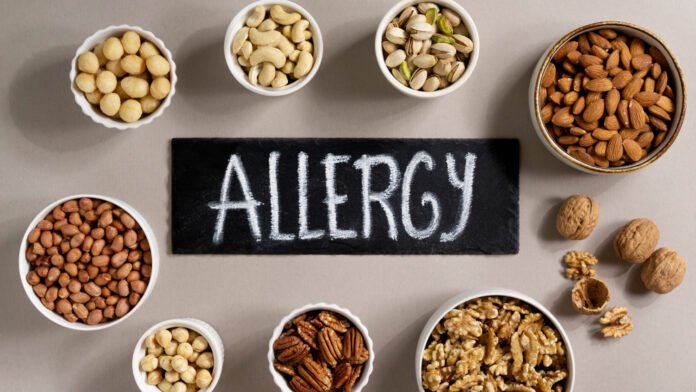 view allergens commonly found nuts